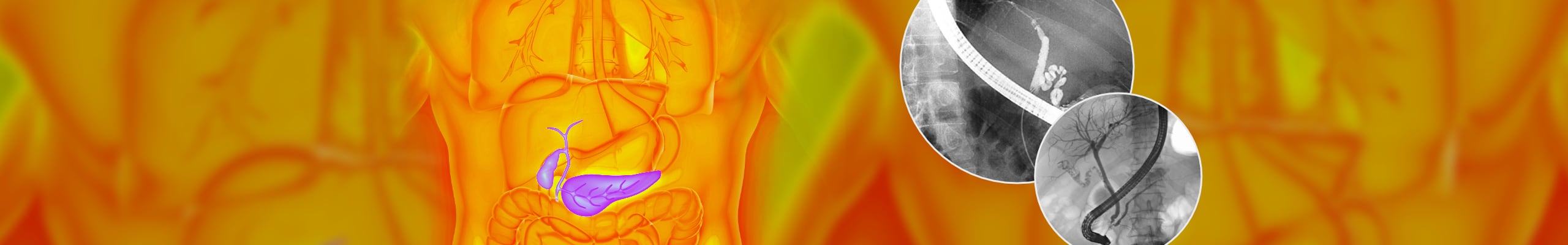 LUKS – Expert Training, Interventionelle ERCP | ©2026 COCS GmbH